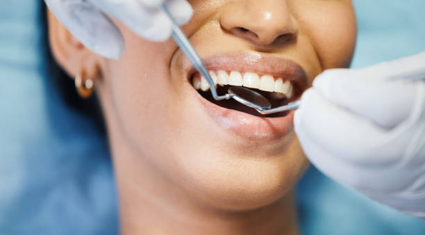 Best Urgent Care for Lost Fillings or Crowns in Montesano, WA